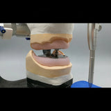 High Quality Intraoral Registration Gothic Arch Tracing Instruments Lab Supplies Lab Accessories