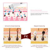 Ultrasonic Skin Scrubber Blackhead Remover Facial Cleanser Peeling Shovel Face Lifting Tool EMS Spatula Deep Cleansing