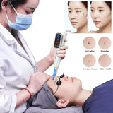 Portable Tattoo Removal Machine Beauty Dent Removal Tool Small Wireless Remove Tattoos Equipment Woman Tattoos Remover Machines