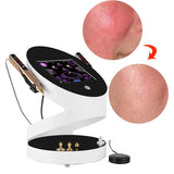 Fibroblast Plasma Pen Jet Plasma Lifting Eyelid Lifting Machine Wrinkle Removal Skin Rejuvenation Acne Remover Plasma Shower