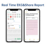 Viatom DUOEK S Bluetooth hine Manufacture Wearable Handheld Ecg Monitor