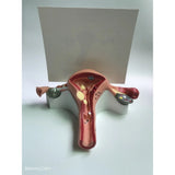 Medical Human Uterus Ovary Pathology Portable Simulation Female Reproductive Model Teaching Anatomy labs Researches