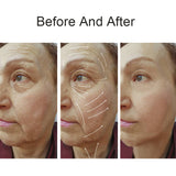 NEW RF Facial Lifting Tightening Machine Portable Radio Frequency Anti Wrinkle Aging Beauty Skin Rejuvenation Device For Eye Spa