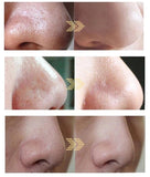 3 in 1 Deep face cleansing Aquasure H2 device H2O2 Water Oxygen Peeling Dermabrasion Cleaning hine skin rejuvenation