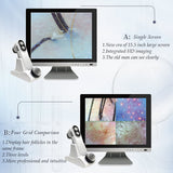 New 15inch HD Scalp/Skin /Hair Follicle Detector 16G Electric UV Testing Analysis Magnifier Professional 50X/200X Skin Analyzer