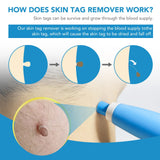 2 In 1 Automatic Kit Miniature Skin Tag Adult Mole Stains Wart Remover Facial Care Beauty Tool