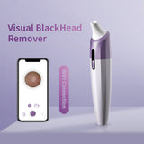 Home Visual Blackhead Beauty Instrument Pore Deep Cleaner Vacuum Silicone Suction Head Cleansing Instrument