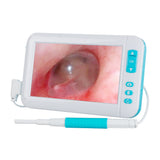 Rechargeable Digital Ear Otoscope Inspection Camera Digital Endoscope Earwax Cleaner for Kids and Adults with 6 LED Lights
