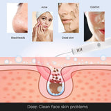 Ultrasonic Skin Scrubber Face Cleaning Tool Blackhead Remover Minimizing Pore Spot Remove Facial Peeg Skincare Beauty hine