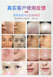 Hot Cold Seven-Color Spectrum LED Light Photon Skin Rejuvenation Skin Whitening Spots Lightening Acne Removing