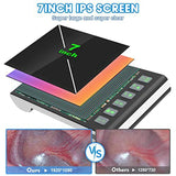 Digital Otoscope with 7-Inch Screen, Camera, Visual Ear Scoop Supports Photo Snapshots and Video Recording,