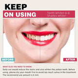 professional teeth advanced gel with denta l whitening kit