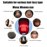 Red Light Therapy Device Hair Growth Cap Anti Hair Loss Hair Growth Laser Helmet Hat Regrowth Hair Growth Treatment Hat Machine