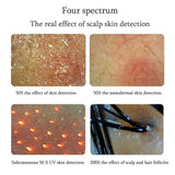 11 Inch LCD Analyzer Digital Microscope Magnifier Skin Hair Blackhead Follicle Scalp Detector 50X-200X