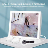 NEW 15inch LCD Scalp/Skin /Hair Follicle Detector Ultra HD UV Testing Analysis Magnifier Professional 50X/200X Skin Analyzer