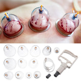 1 Set 12-Cup Cupping Therapy Set Muscle Pain Relief Device Body Massager Pump
