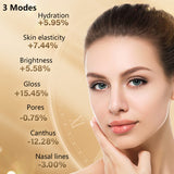 Ultrasound Anti-wrinkle Facial Massager RF Radio Frequency Face Lifting REJ EMS Led Light Therapy Skin Firming Beauty Machine