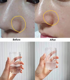 Oxygen Therapy Jet Peel Cleaning Machine Skin Rejuvenation Microdermabrasion Pore Clean Water Aqua Peel Hydroning Face Care Tool