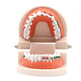 Dental Orthodontic Treatment Model With Ceramic Bracket Arch Wire Ortho Metal Orthodontic Toothed Denture Model