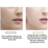 Blackhead Remover Ultrasonic Skin Scrubber Facial Cleaner Ion Acne Peeling Shovel Cleaner Facial Massager Tool Face Lift Machine