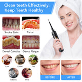 Electric Vibration Dental Calculus Remover Teeth Cleaner Dental Cleaning Teeth Whitening Scaler Tartar Remover Oral Irrigator