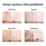 The New 6 in 1 Portable Hydro Dermabrasion Skin Care Beauty Machine Water Oxygen Jet Hydro Diamond Peeling Microdermabrasion