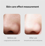 2021 Newest Design Skin Care Product Hot Compress Electric Facial Blackhead Remover Vacuum Pore Cleaner Original
