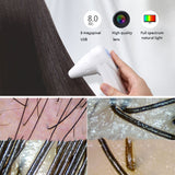 8.0 MP USB Ditital Optical Irides Analyzer Skin Hair Detector Camera UV Hair Follicle Tester Instrument Magnification 30x