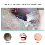 Smart Visual Ear Cleaning Otoscope Otoscope-Ear Scope Camera Ear Wax removal Tools Home Ear Inspection for Kids and Adults