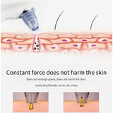 Blackhead Removers Acne Black Head Remover Beauty Aspirateur Skin Tag Remover Black Dot Beauty Clean Skin Tools