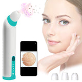 WiFi Visual Blackhead Remover Vacuum with Camera 30X HD Visible Facial Pore Cleaner Acne Extractor Probes Suction for Women Men