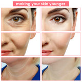 EMS Radio Frequency Face Massager Lifting Firming Anti Aging LED Face Light Therapy Skin Rejuvenation Spa Acne Remover Skincare