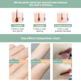 990000 Flash IPL Laser Hair Removal Machine Laser Epilator Hair Removal Device Permanent Bikini Trimmer Depilador a laser women