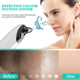 Face Blackhead Remover Vacuum with WiFi Visual 30X 1080P HD Camera Facial Pore Cleaner Kit Acne Extractor Probes for Women Men