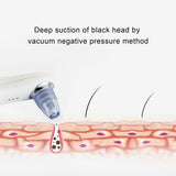 Blackhead Facial Pore Cleaner Electric Acne Removal Facial Instrument Cleaner Beauty Electric Blackhead Suction Device
