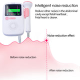 Upgraded Color LCD Curve Doppler Fetal Heart rate Monitor Home Pregnancy Baby Fetal Sound Heart Rate Detector No Radiation