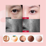 EMS Face Mask Lifting Machine Facial Muscle Stimulator V Shape Massager Blackhead Remover Freckle Whitening Skin Firming Tool