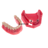 Dental Implant Restoration Teeth Model Removable Bridge Denture Teaching research model
