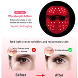 Skin Care Household Face Wrinkle Removal Daily LED Light Therapy for Protective Spa USB Rechargeable Electric Acne Treatment