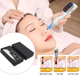 Skin Mole Dark Spot Remover Laser Picosecond Pen Facial Pigment Freckle Removal Machine Remove Tattoo Acne Spa Skin Care Beauty