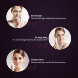 Facial RF Radio Frequency For Lifting Face Wrinkle Removal, Skin Tightening Beauty Care beauty machine