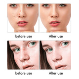 LCD 9 Level Laser Plasma Pen Mole Tattoo Freckle Wart Tag Removal Pens Dark Spot Remover Skin Care Tools Women Beauty Instrument