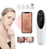 Visual Blackhead Remover Vacuum with Camera Vacuum Pore Cleanser Black Head Remover Deep Nose Pore Cleaner Acne Pimple Removal
