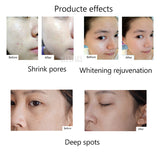 Mini Hydra Injector Gun Nano Water Mesotherapy Injector Tools Microneedle Pen Mesogun Needles Injection Facial Treatment