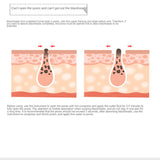 Electric Beauty Cleanser Vacuum Blackhead Remover Instrument Acne Pore Cleaning Multi-Functional Ultrasonic Facial Clean Device