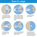 Auto Skin Tag Remover Painless Facial Beauty Tools Mole Wart Spot Skin Tag Removal Kit With Cleansing Swabs Home Use