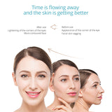 NEW EMS Facial Massager Face Lifing Electroporation RF Radio Frequency Machine LED Photon Ion Import Skin Care Device