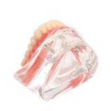 1pcs Dental Over denture Inferior Teeth Model With 2 Implant Demo Teeth Study Model Practical Dental Model Accessories