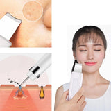 Facial Cleaning Ultrasonic Skin Scrubber Cavitation Peeling  Deep Clean Ultrasonic Exfoliating Spa Scraper to Remove Blackheads