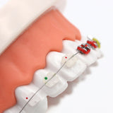 Dental Orthodontic Treatment Model With Ceramic Bracket Arch Wire Ortho Metal Orthodontic Toothed Denture Model